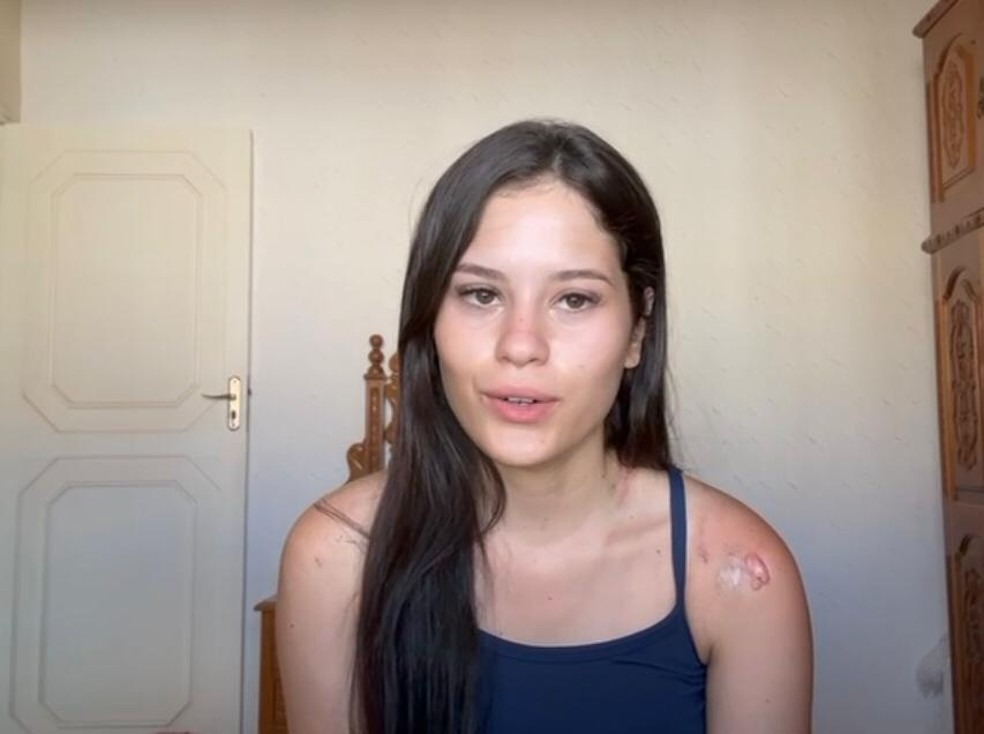 'Sai para me divertir e voltei machucada', diz jovem que sofreu queimaduras durante festa no interior de SE