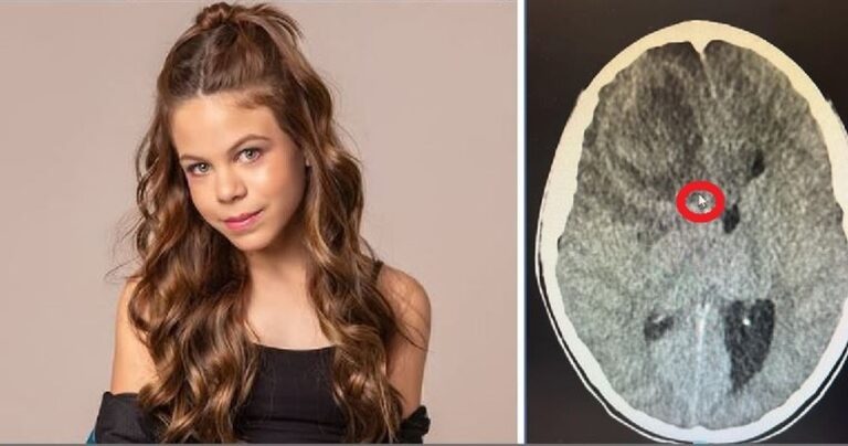 Atriz mirim morre aos 11 anos após dias de sintomas graves