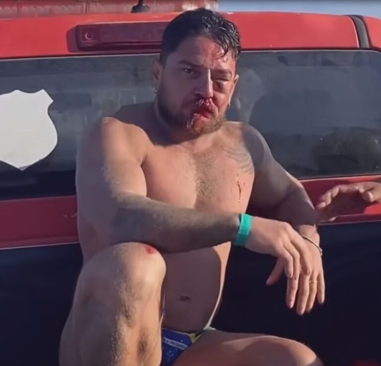 Casal é agredido após cobrança por uso de cadeiras de praia: 'Eu vi a morte na nossa frente'