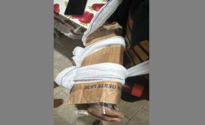 Criança quebra braço e sai da UPA com imobilização improvisada de papelão 