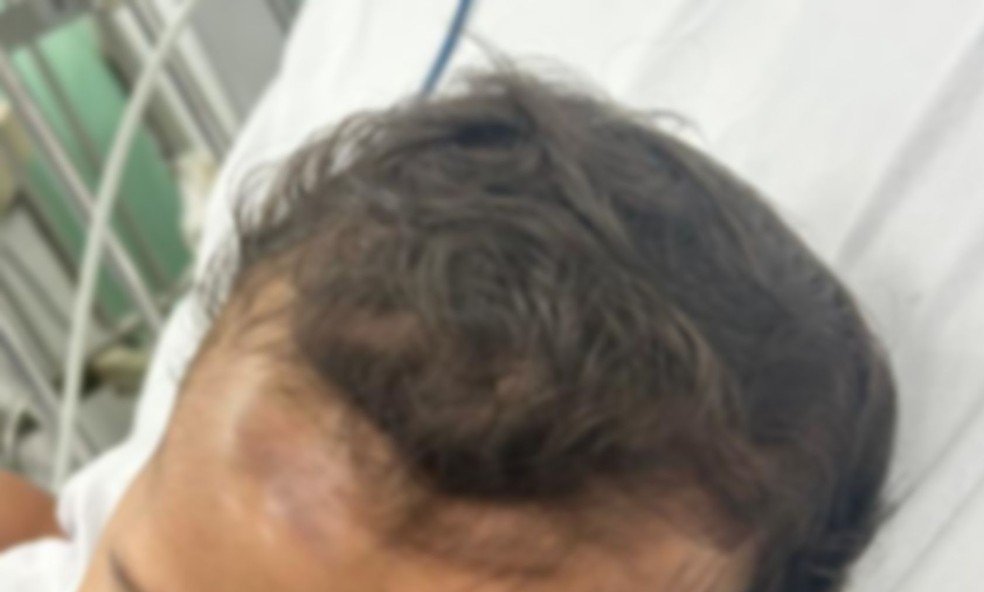 Mãe denuncia queda de aparelho médico sobre cabeça de bebê de 8 meses em hospital de Aracaju
