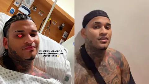 Cantor Anderson Neiff passa por cirurgia após ser baleado ao sair de show